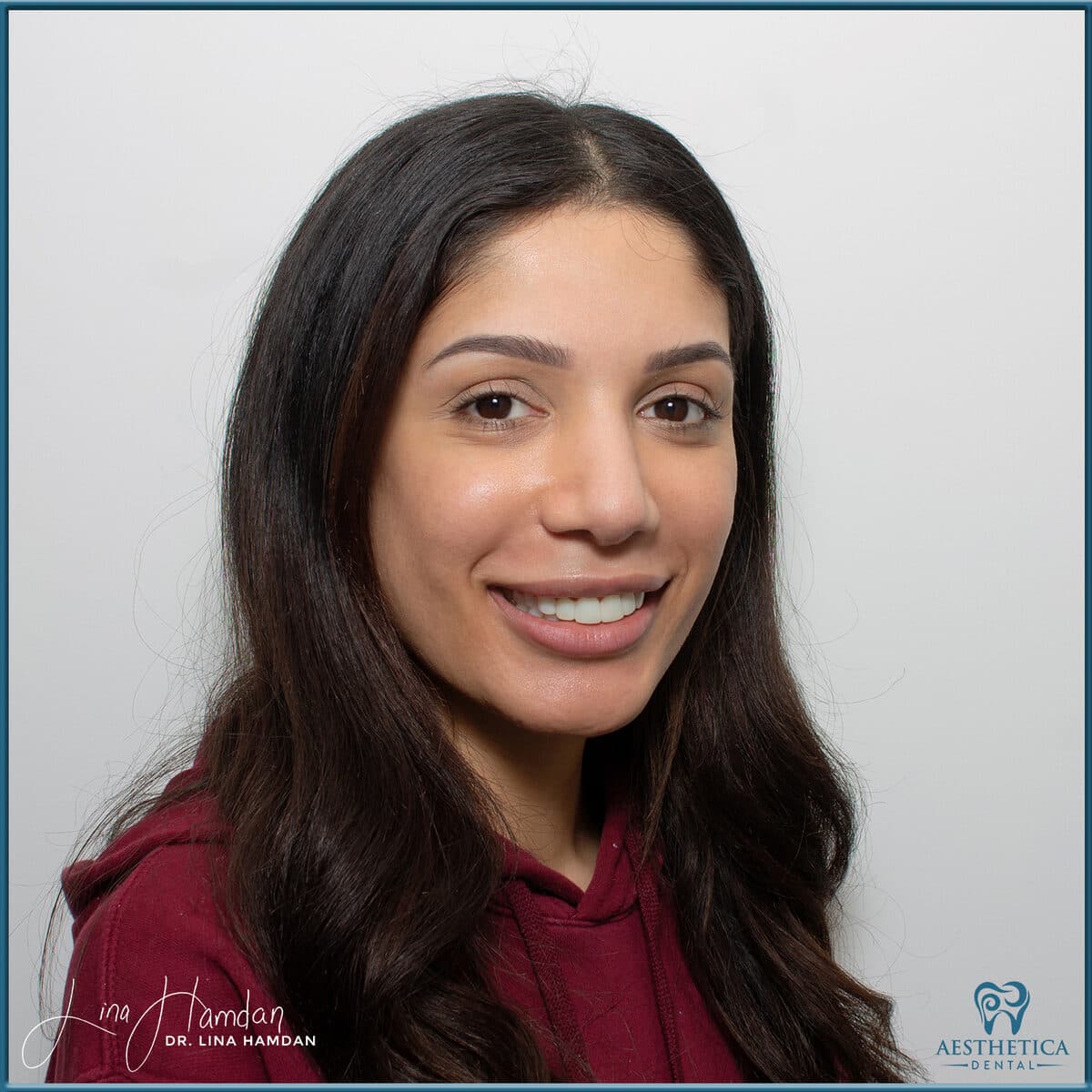 Composite bonding: anonymous case 164 from Aesthetica Dental Naperville