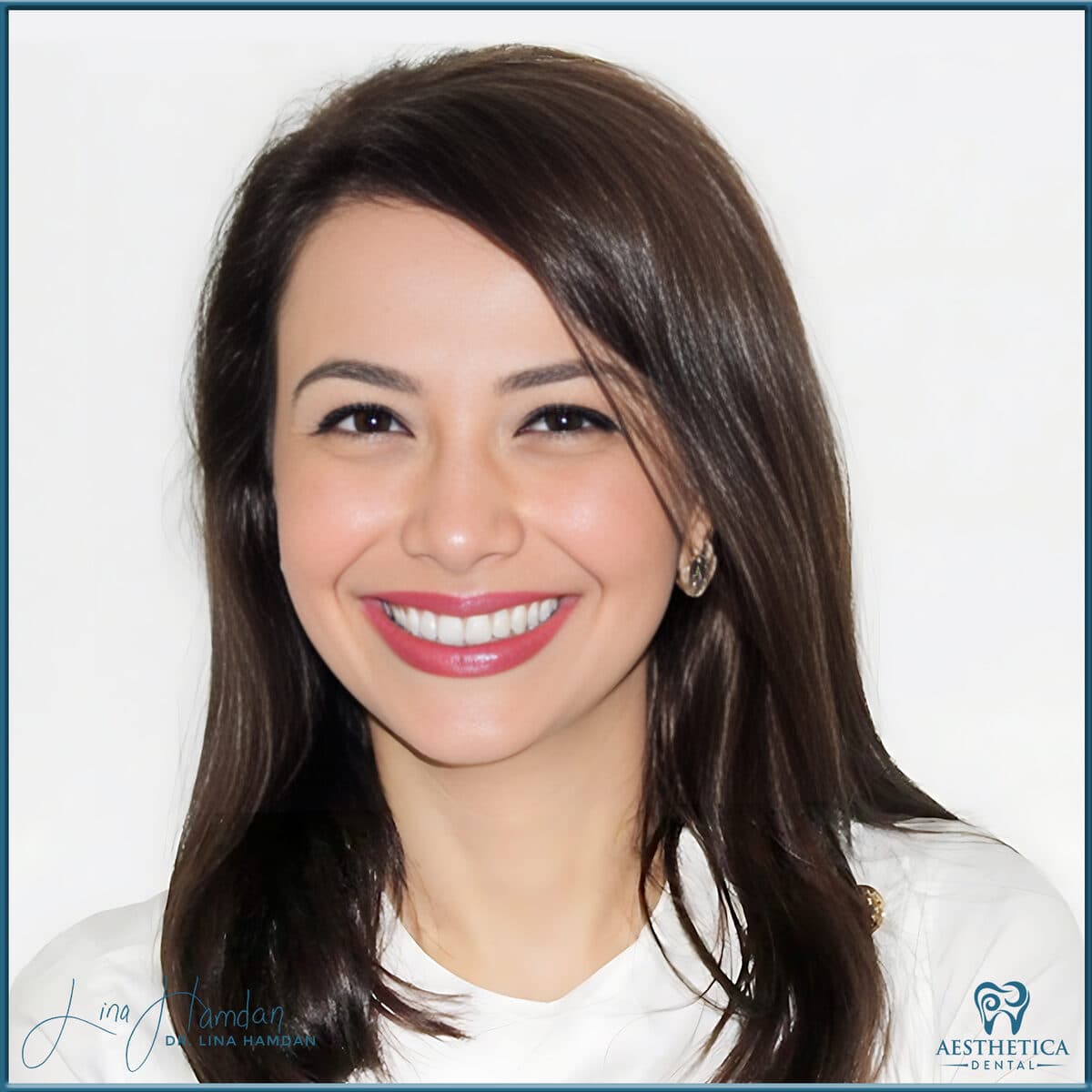 Considered porcelain veneers: anonymous case 62 from Aesthetica Dental Naperville