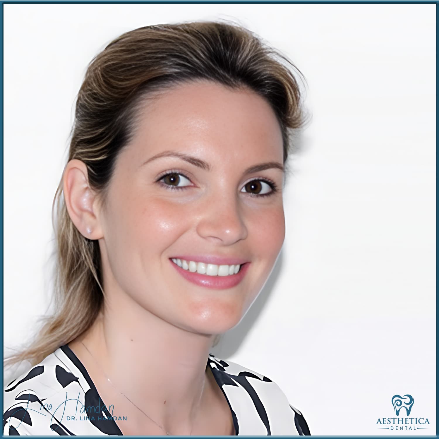 A full re-design of the smile: anonymous case 24 from Aesthetica Dental Naperville