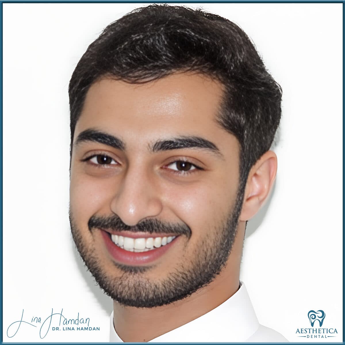 Teeth whitening case 7, anonymous patient at Aesthetica Dental Naperville, photo 1