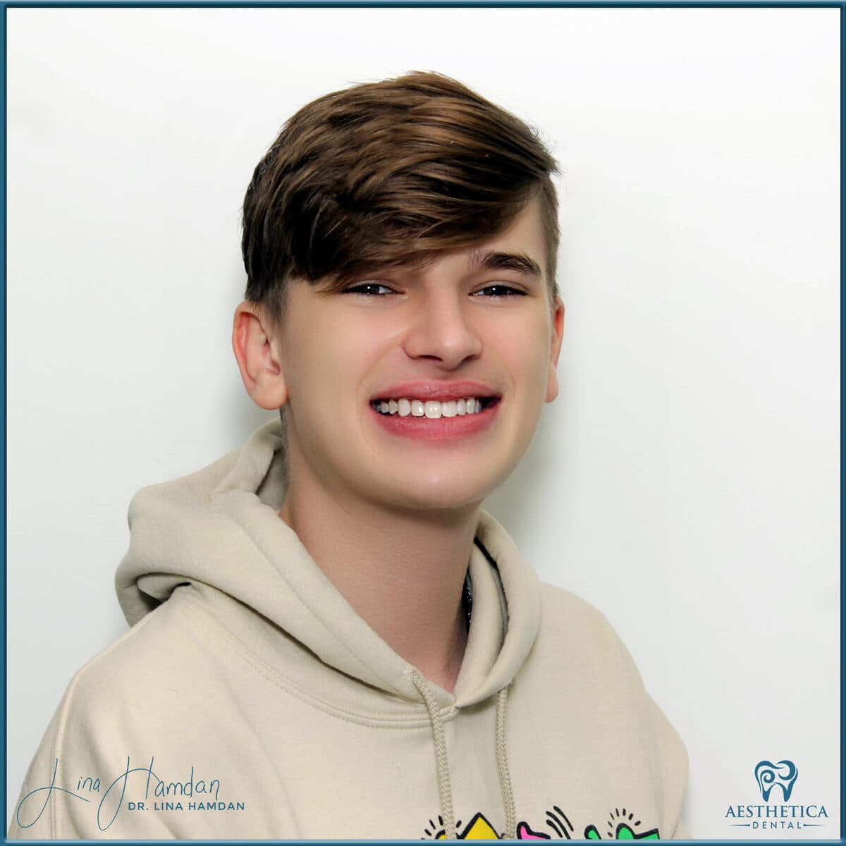 Teeth whitening case 6, anonymous patient at Aesthetica Dental Naperville, photo 1