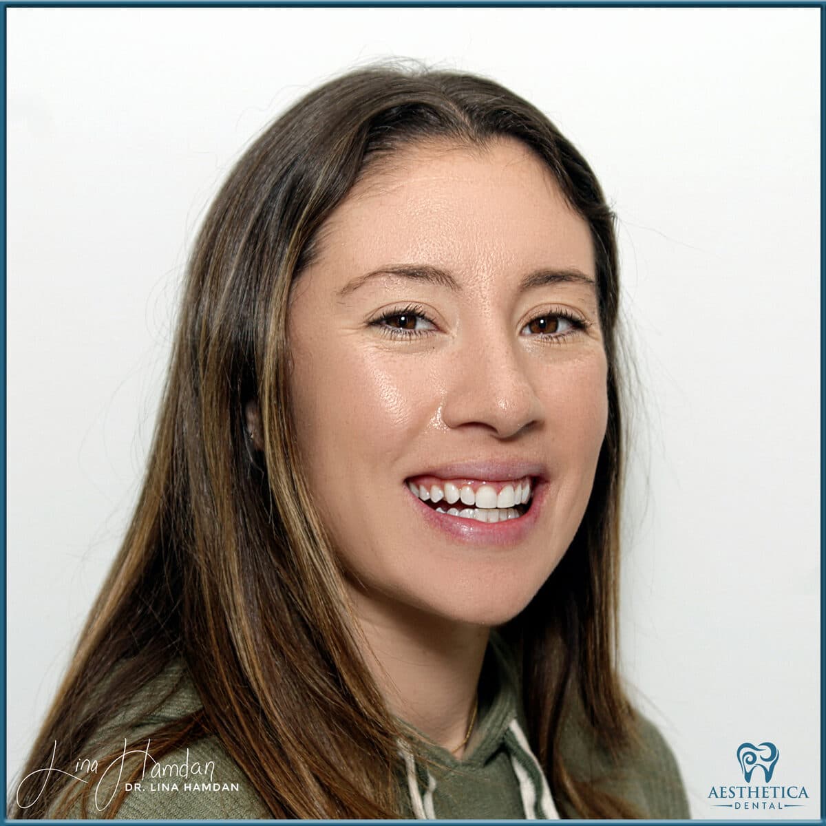 Teeth whitening case 13, anonymous patient at Aesthetica Dental Naperville, photo 1