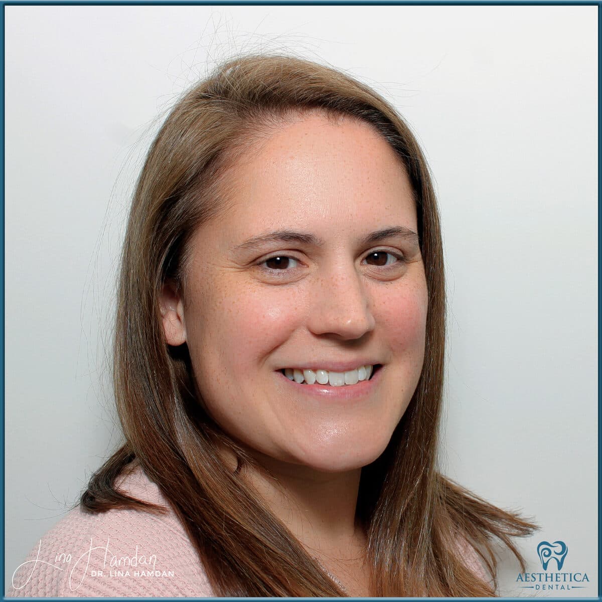 Teeth whitening case 4, anonymous patient at Aesthetica Dental Naperville, photo 1