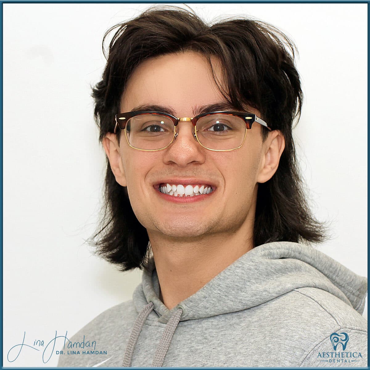 Teeth whitening case 3, anonymous patient at Aesthetica Dental Naperville, photo 1
