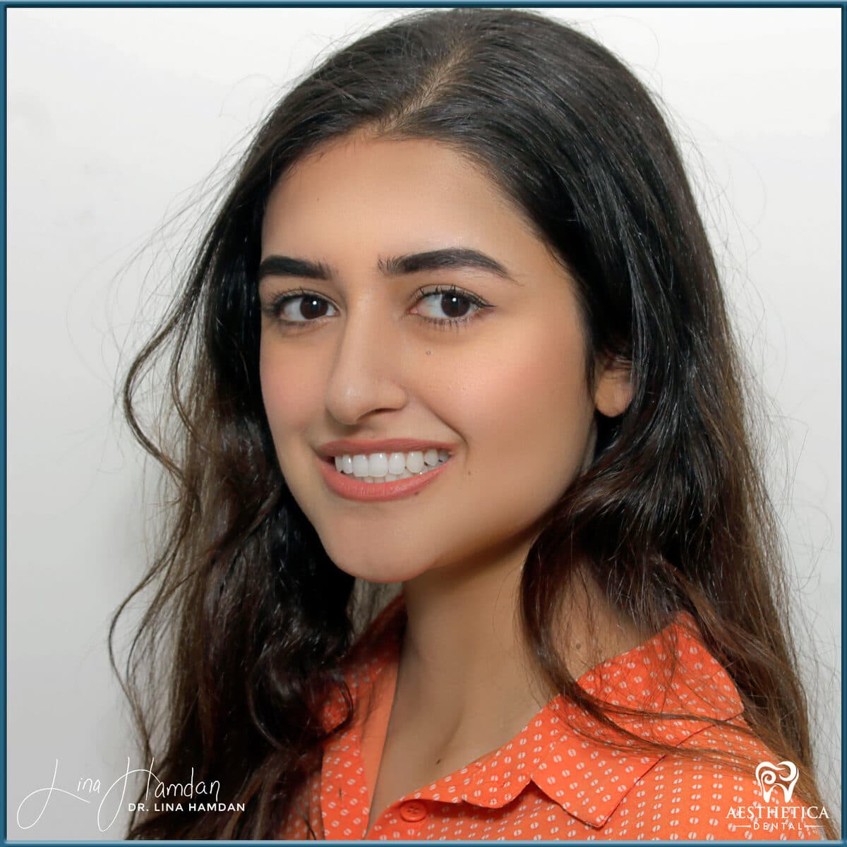 Teeth whitening case 2, anonymous patient at Aesthetica Dental Naperville, photo 1