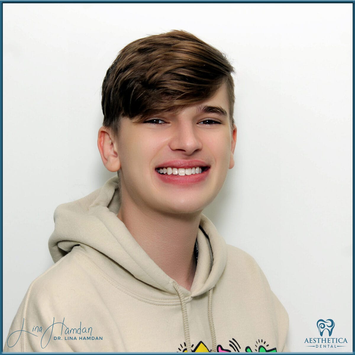 Teeth whitening case 6, anonymous patient at Aesthetica Dental Naperville, photo 1